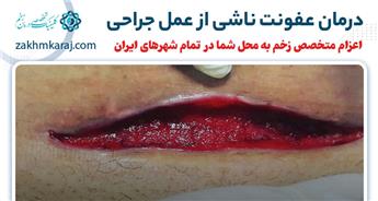 درمان عفونت زخم جراحی